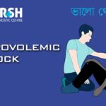 Hypovolemic Shock