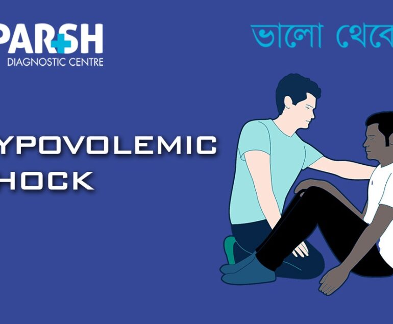 Hypovolemic Shock