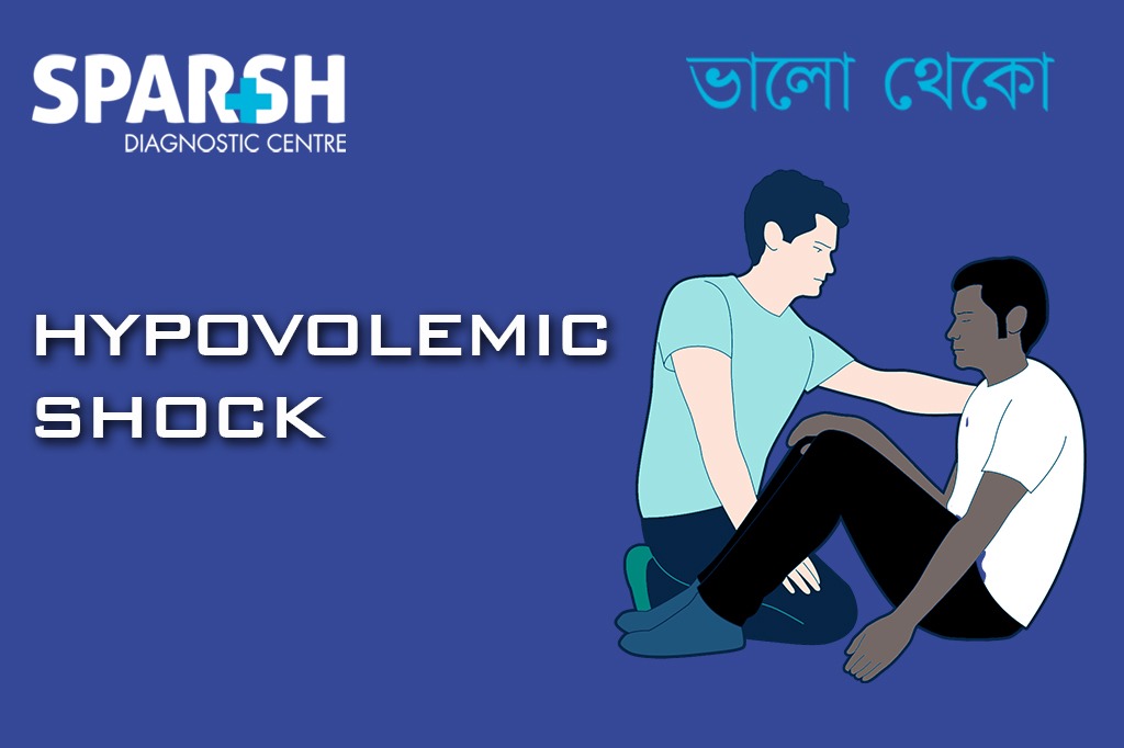 Hypovolemic Shock