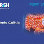 Ischemic Colitis CP