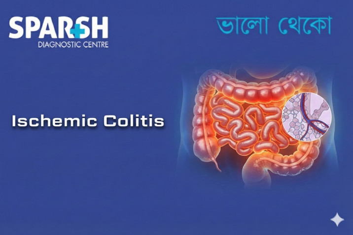 Ischemic Colitis CP