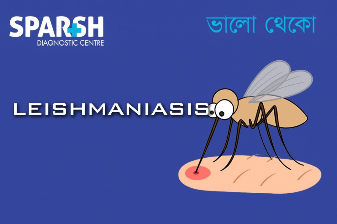 Leishmaniasis