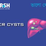 Liver Cyst