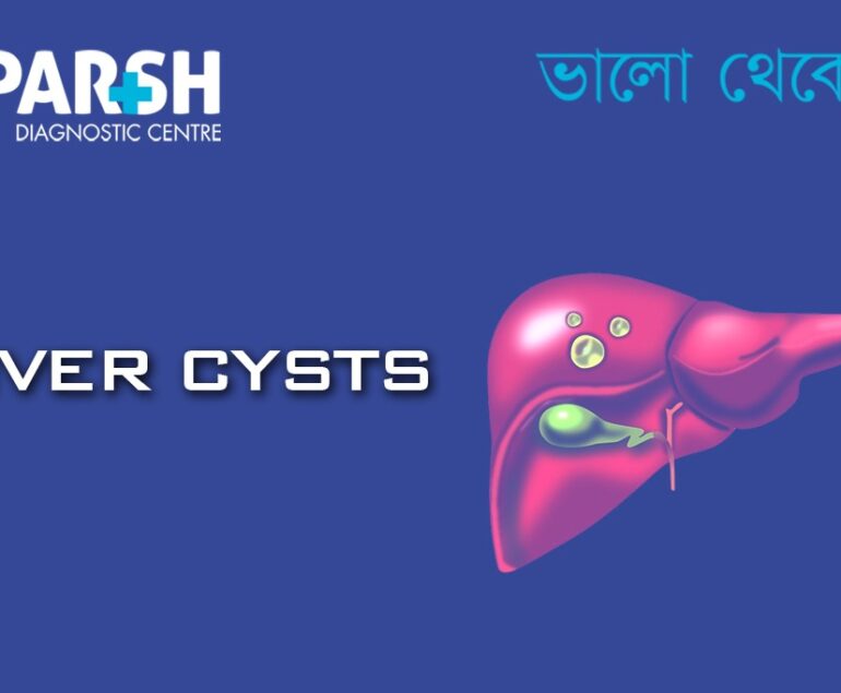 Liver Cyst