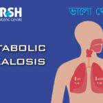 Metabolic Alkalosis