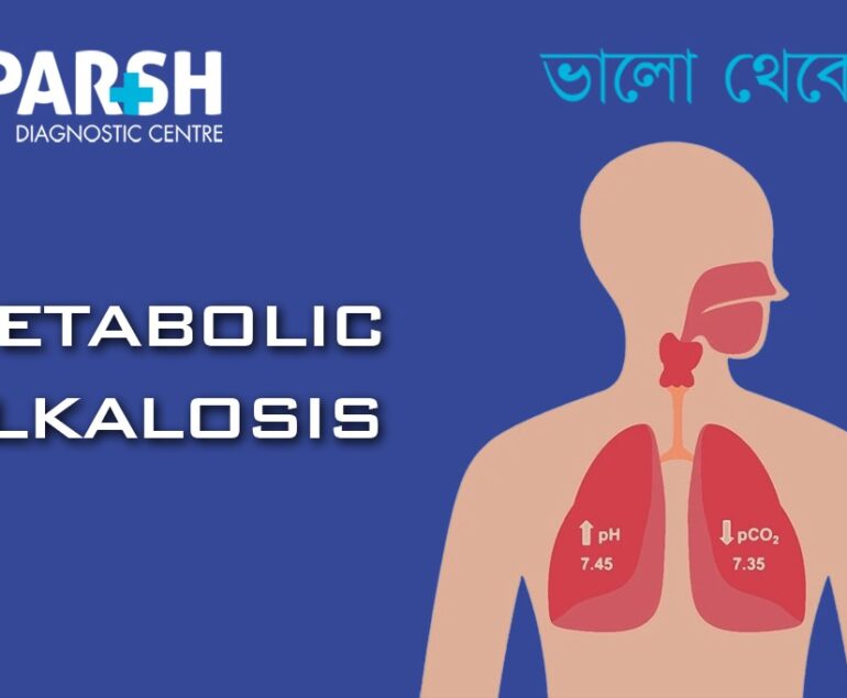 Metabolic Alkalosis