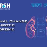 Minimal Change Nephrotic Syndrome