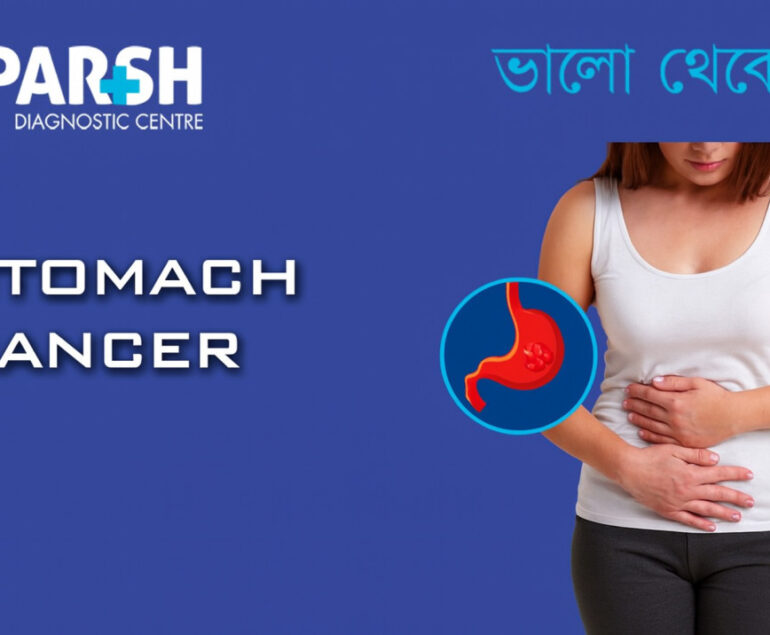 Stomach Cancer