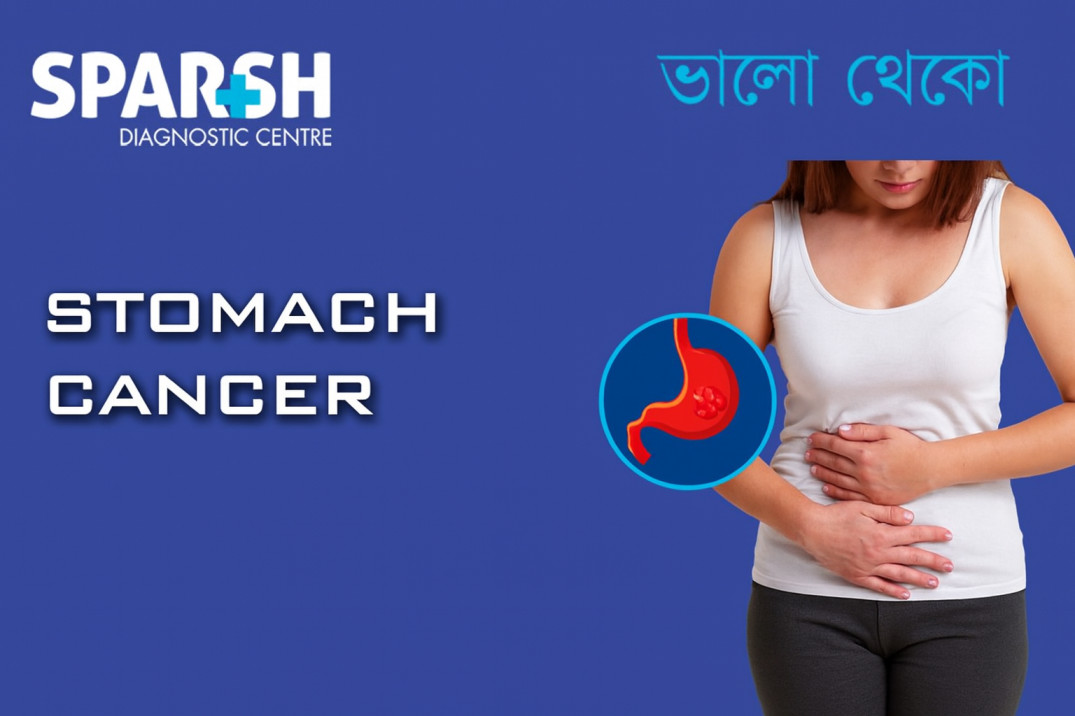 Stomach Cancer