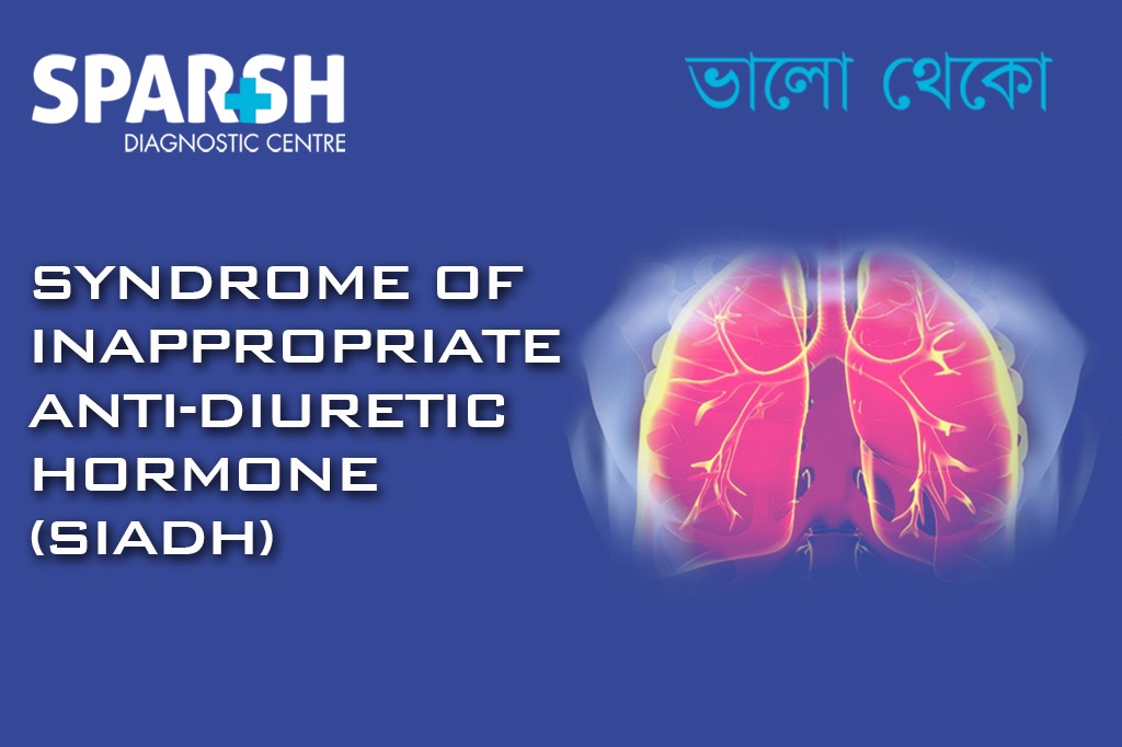 Syndrome Of Inappropriate Anti Diuretic Hormone CP