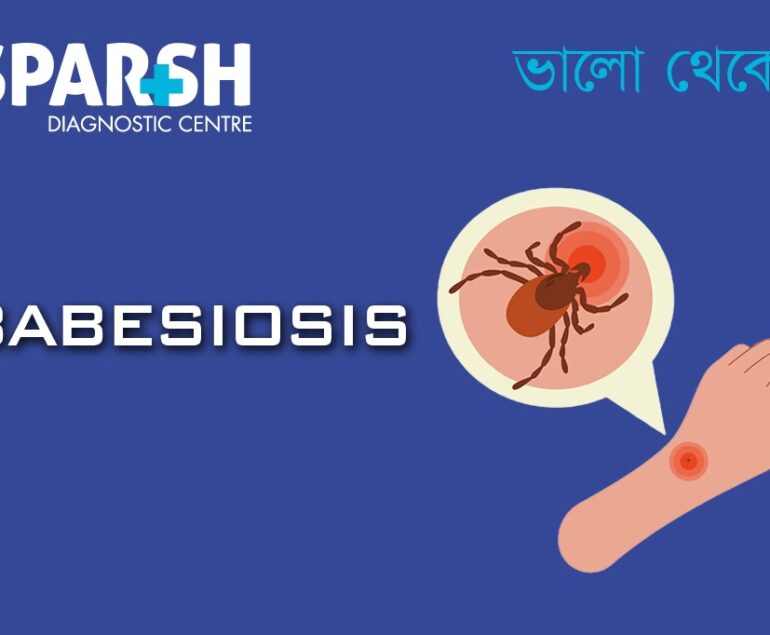 Babesiosis