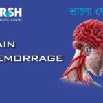 Brain Hemorrrhage