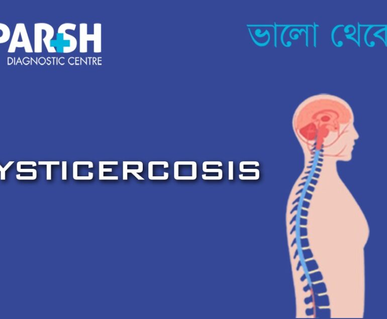 Cysticercosis