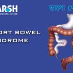 Short Bowel Syndrome