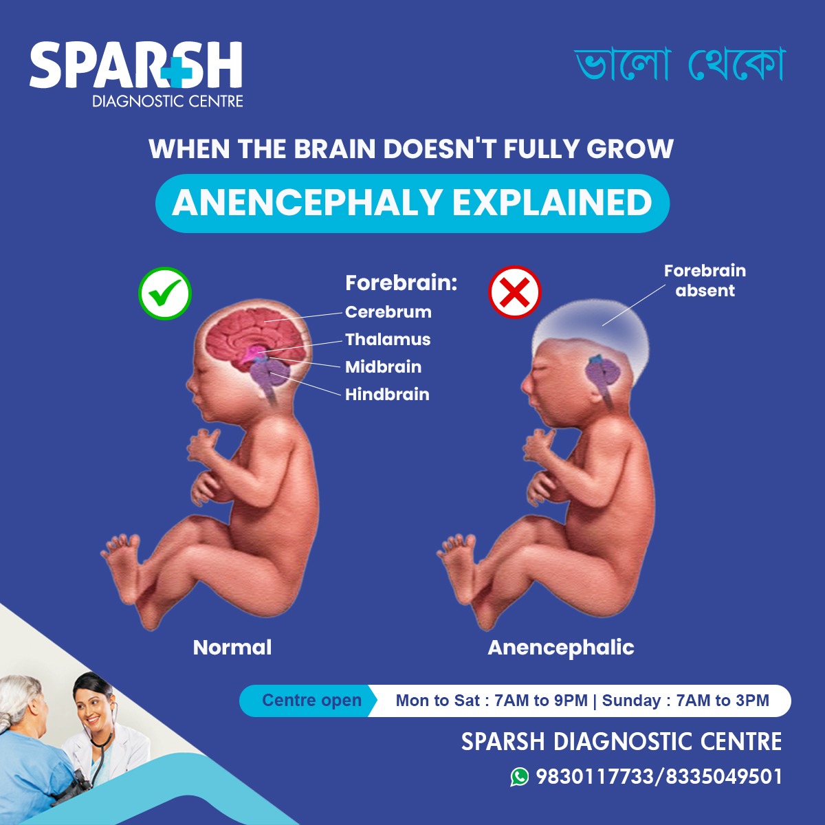 Anencephaly Explained