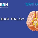 Bulbar Palsy