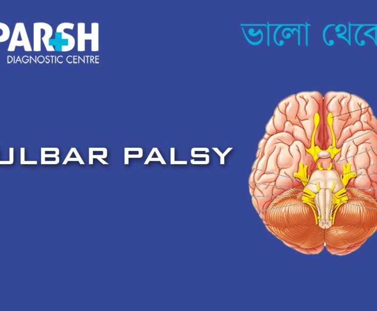 Bulbar Palsy