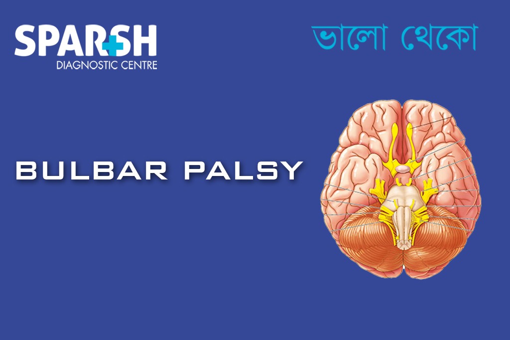 Bulbar Palsy