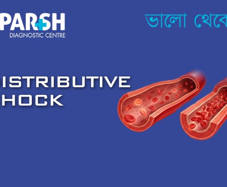Distributive Shock CP