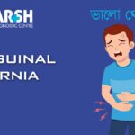 Inguinal Hernia