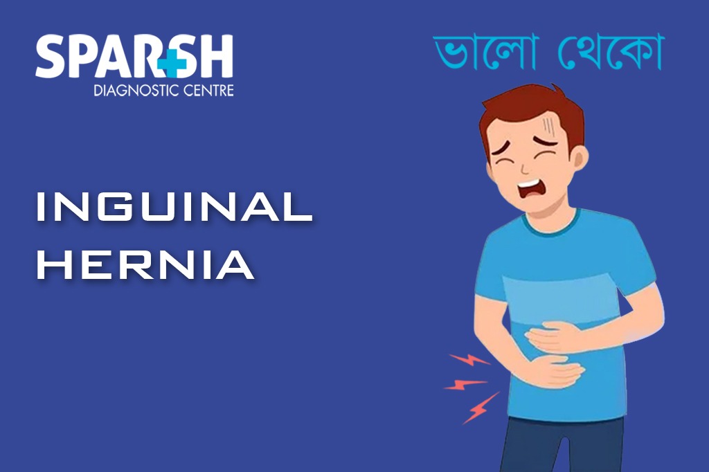 Inguinal Hernia