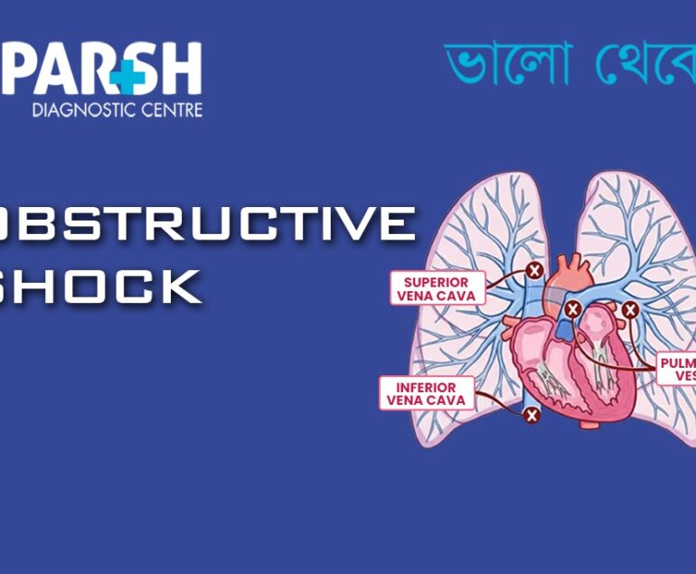 Obstructive Shock CP