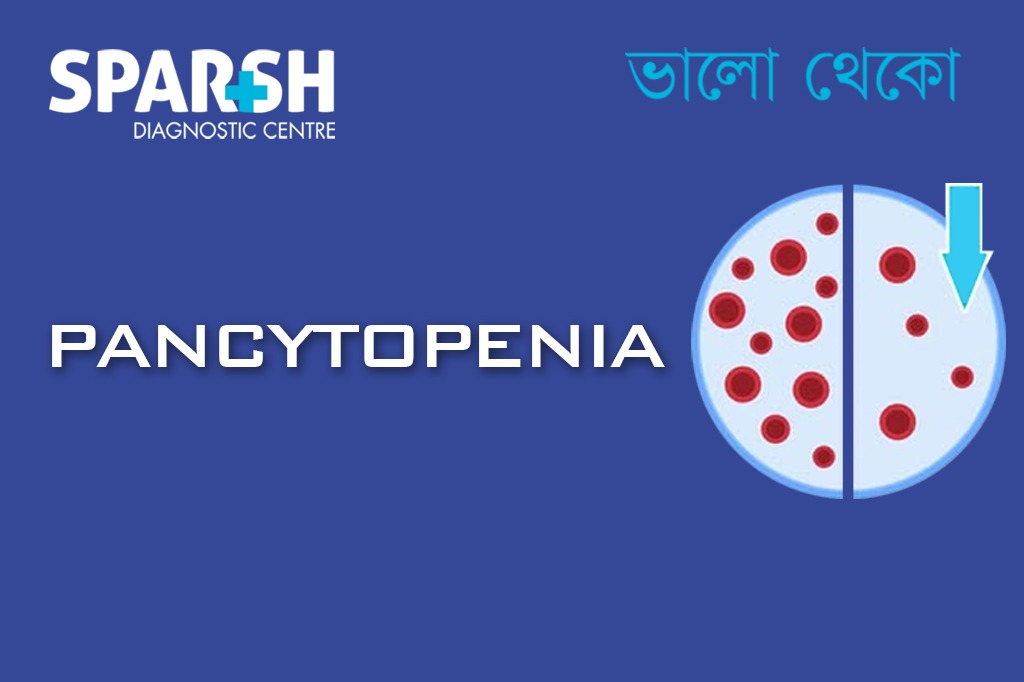 Pancytopenia CP