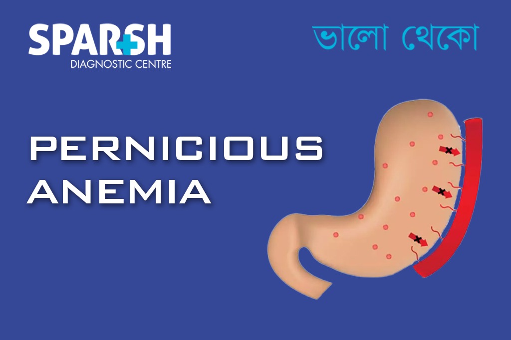 Pernicious Anemia CP