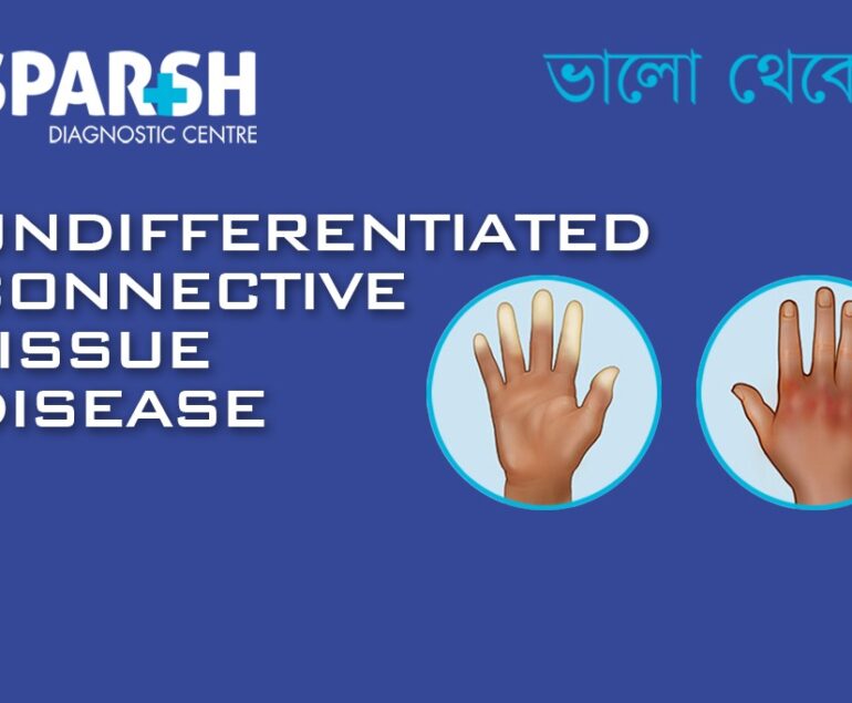 Undifferentiated Connective Tissue Disease