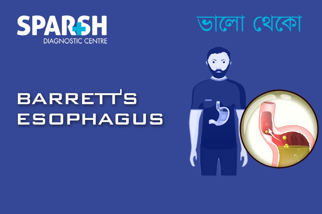 Barretts Esophagus CP