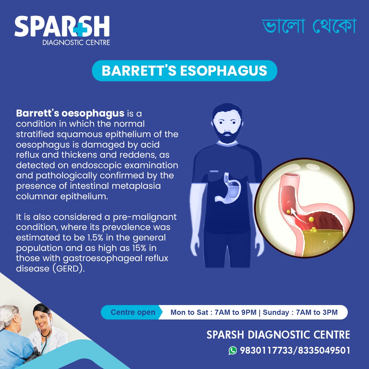 Barretts Esophagus