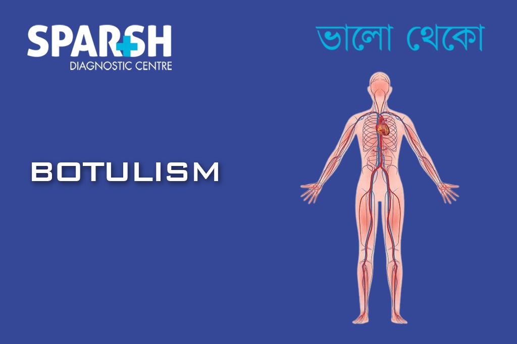 Botulism