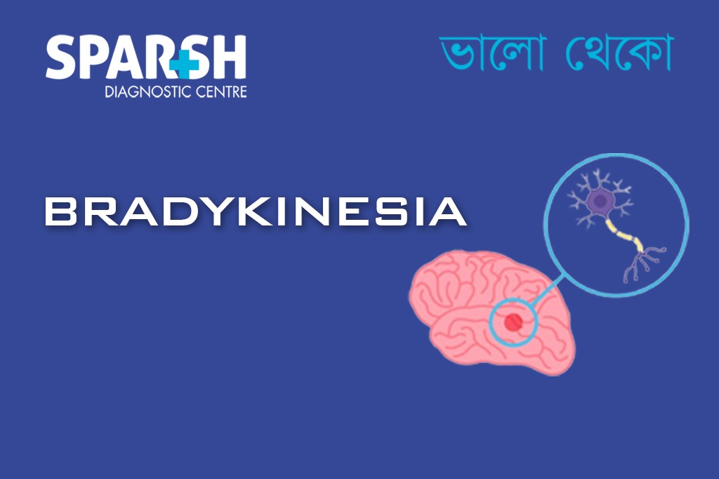 Bradykinesia