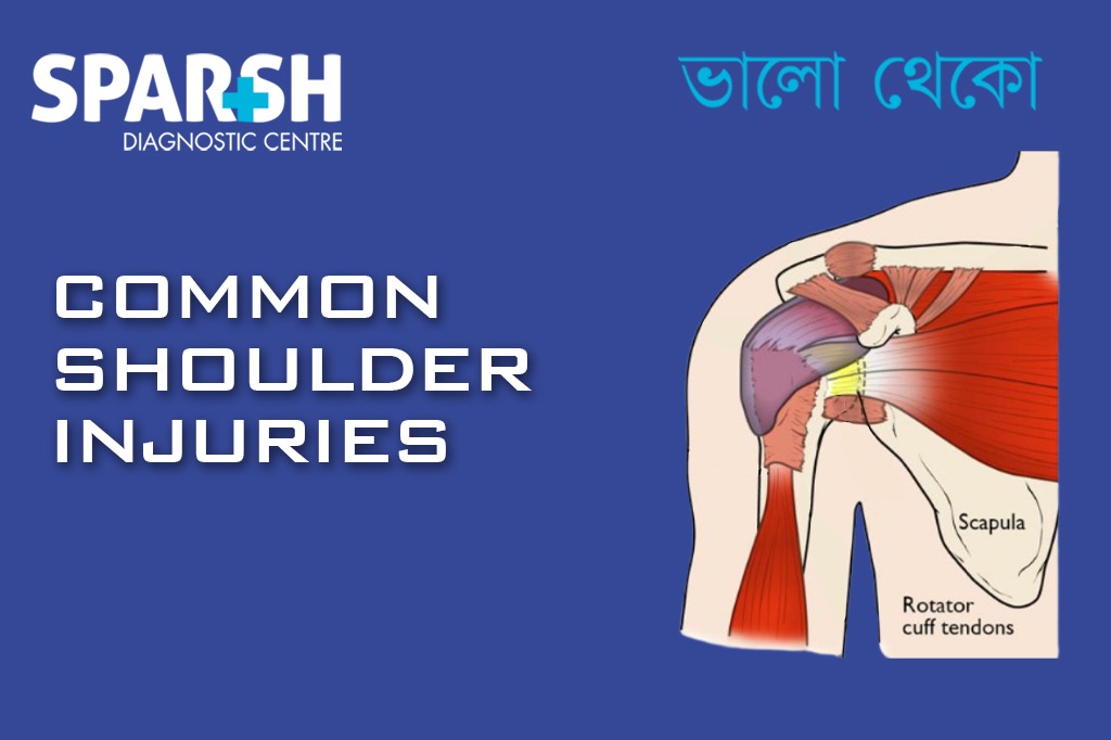 Common Shoulder Injuries
