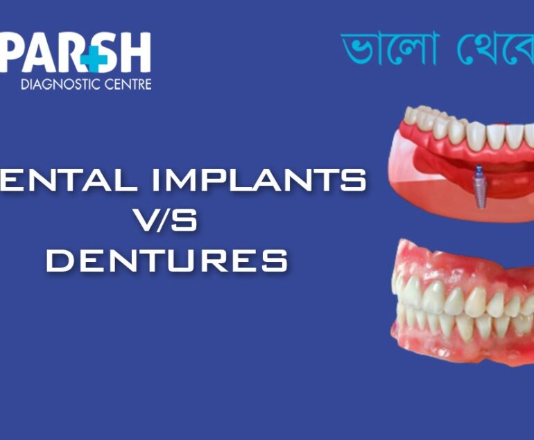 Dental Implants Vs Dentures CP