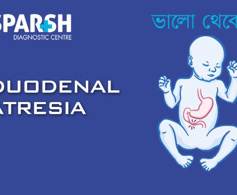 Duodenal Atresia