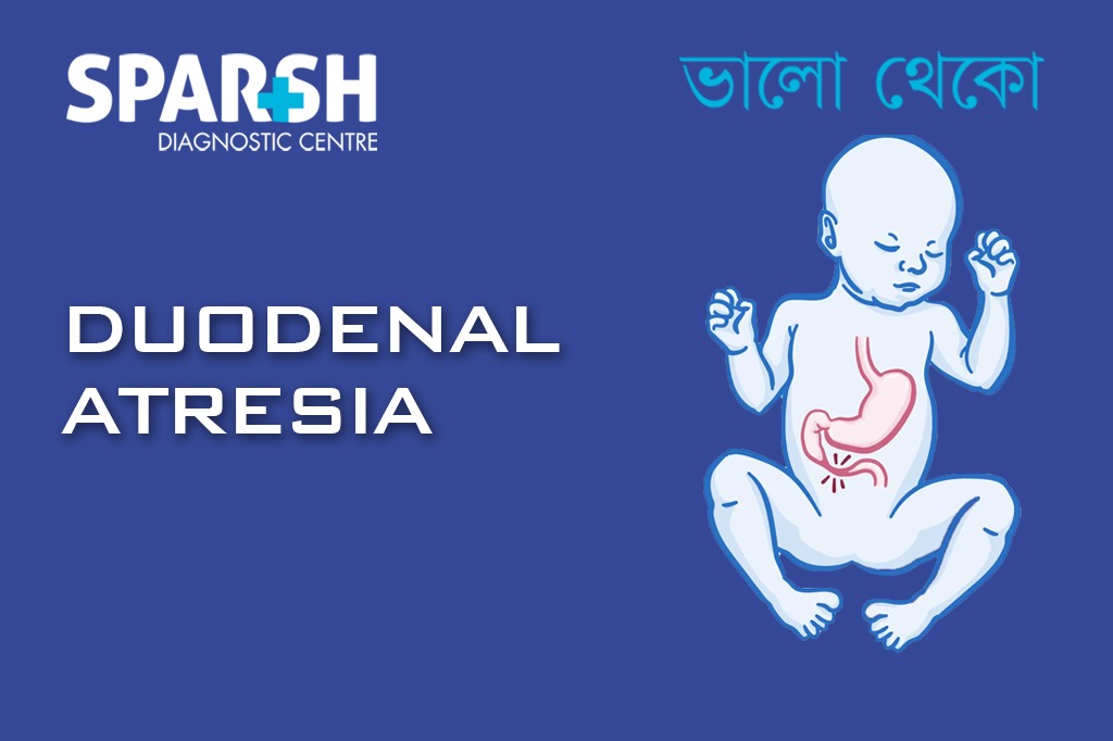 Duodenal Atresia