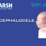 Encephalocele CP
