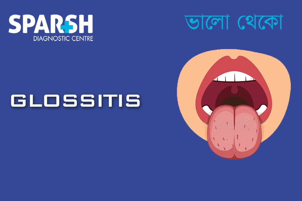 Glossitis