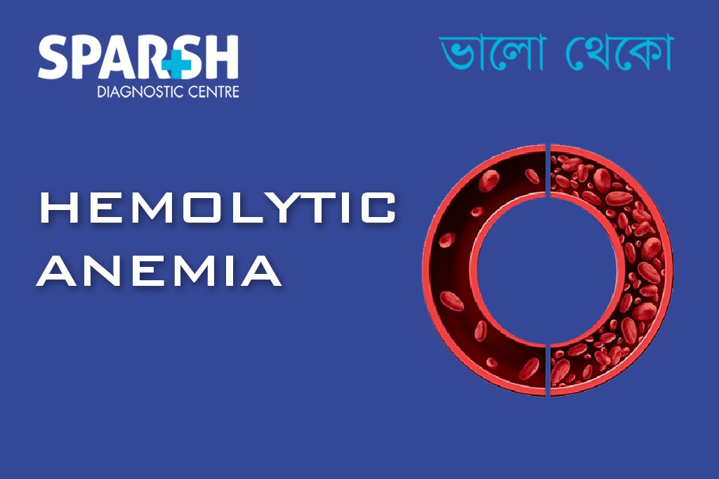 Hemolytic Anemia
