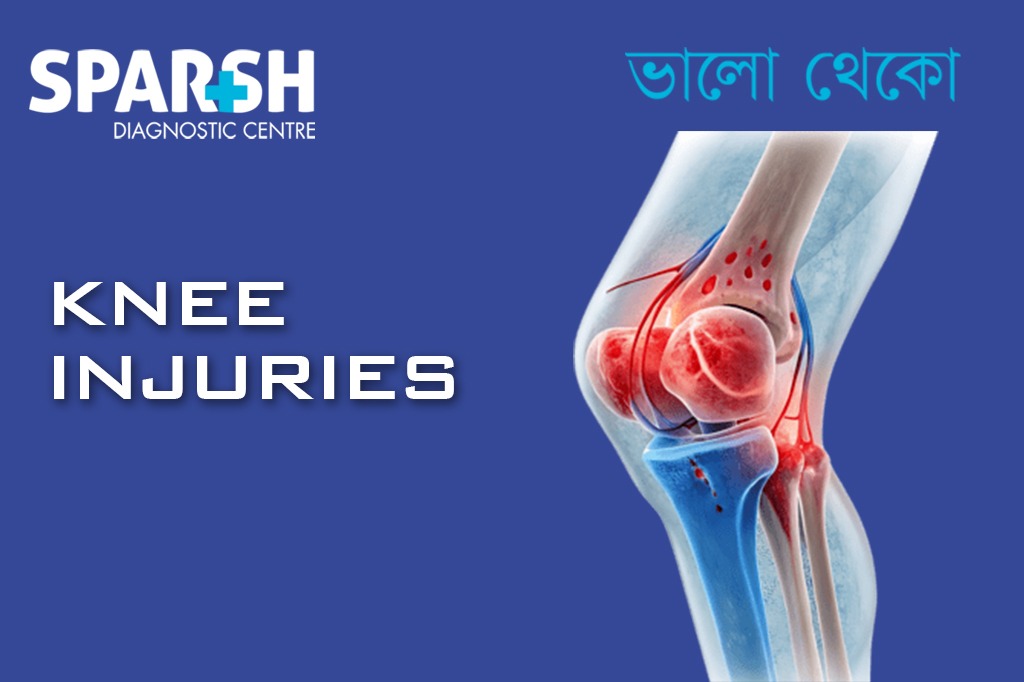 Knee Injuries CP
