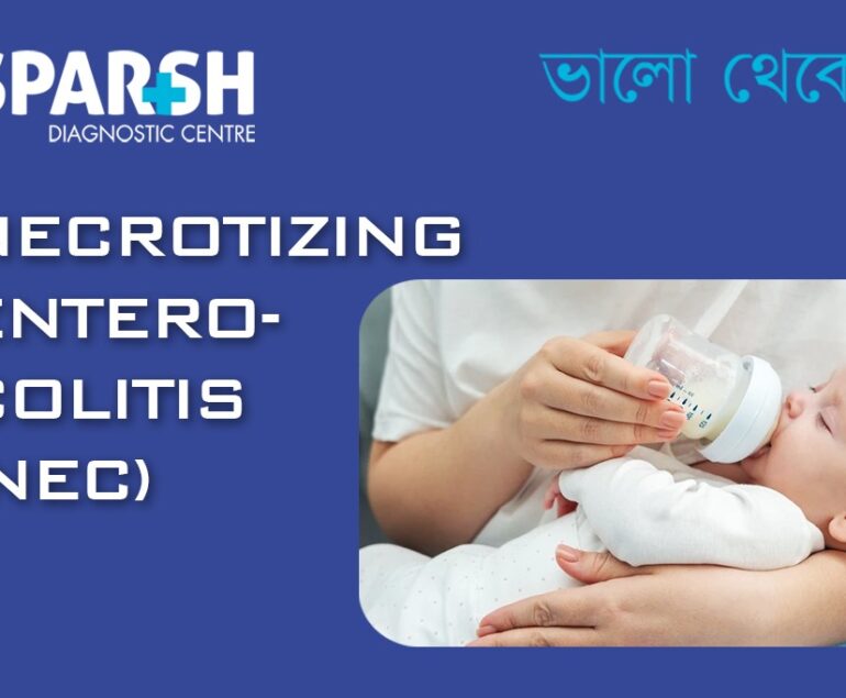 Necrotizing Entero Colitis