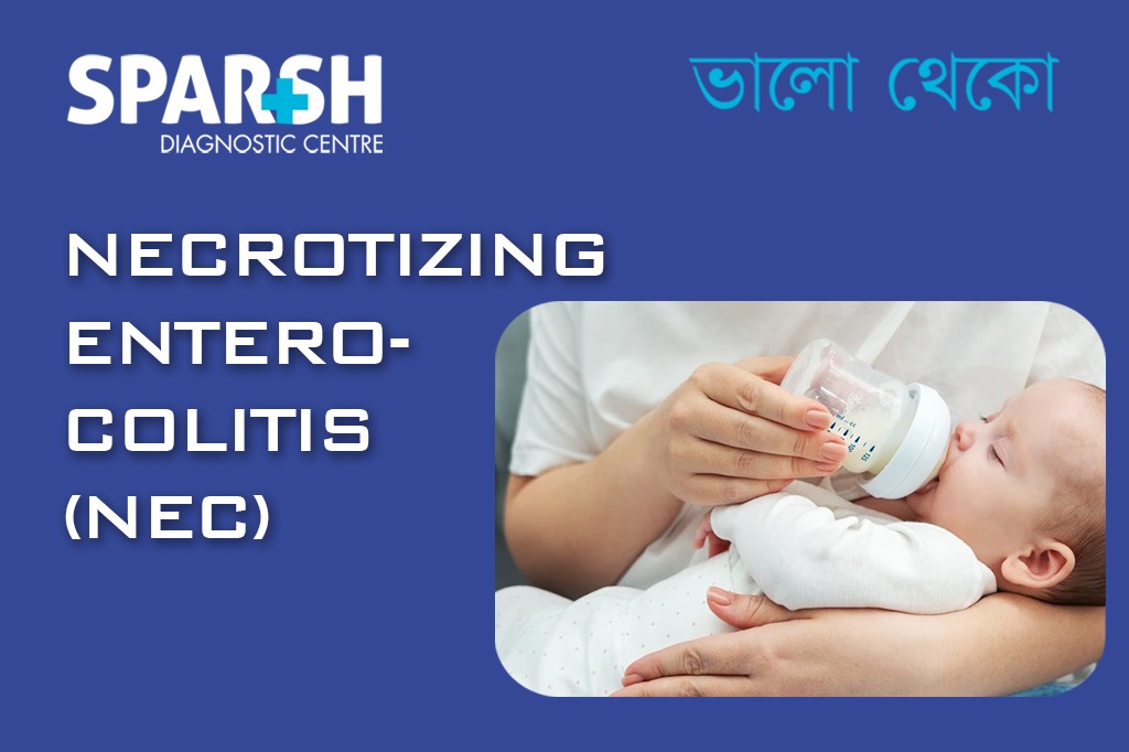 Necrotizing Entero Colitis