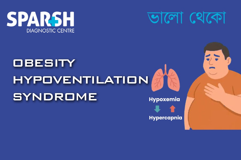 Obesity Hypoventilation Syndrome