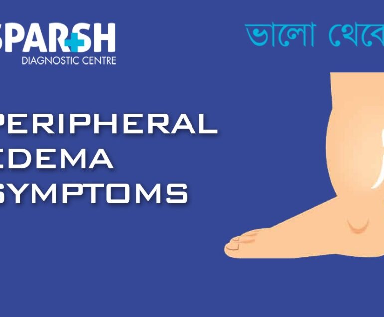Peripheral Edema