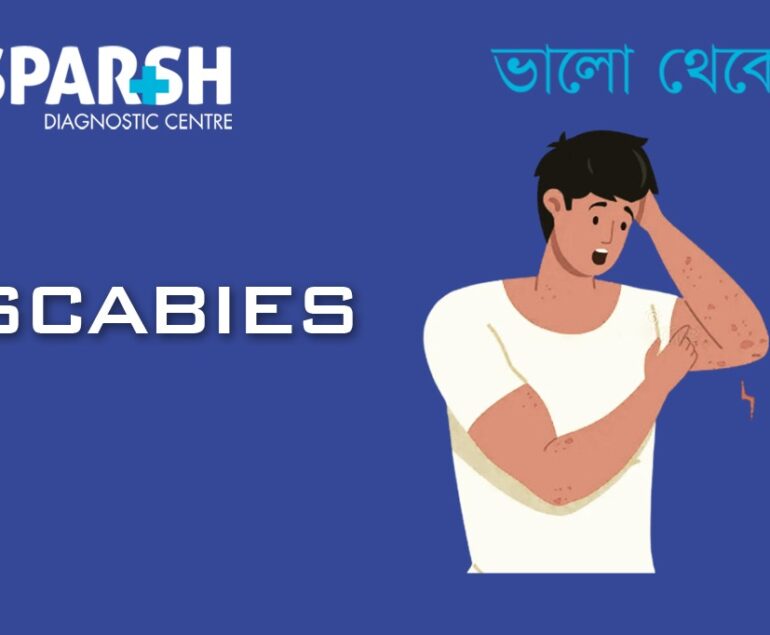 Scabies