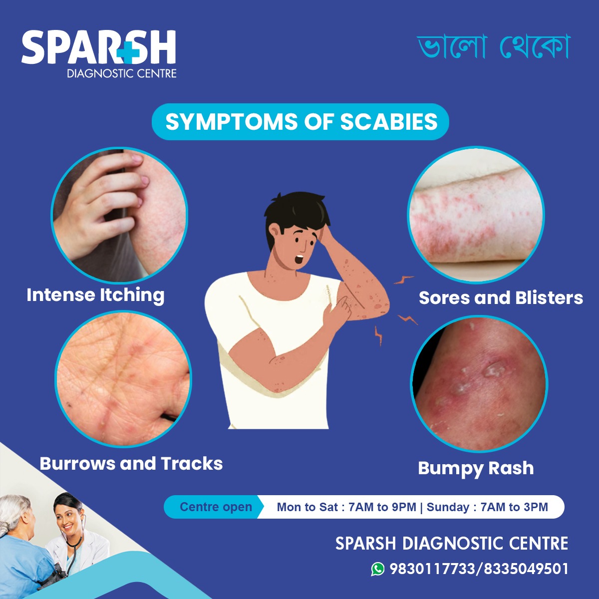 Scabies Symptoms