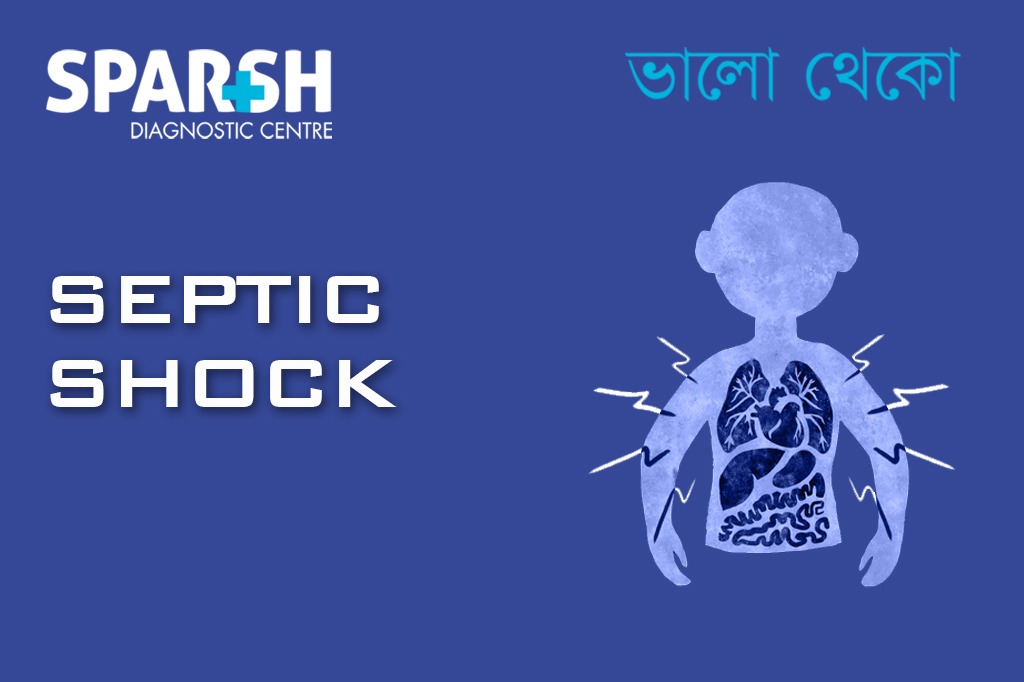 Septic Shock