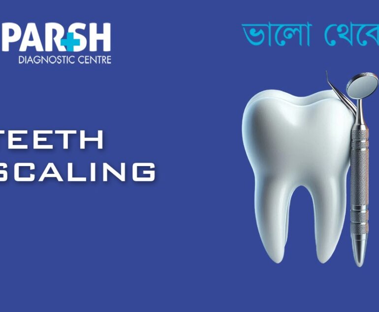 Teeth Scaling