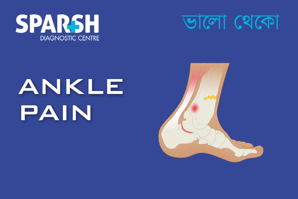 Ankle Pain